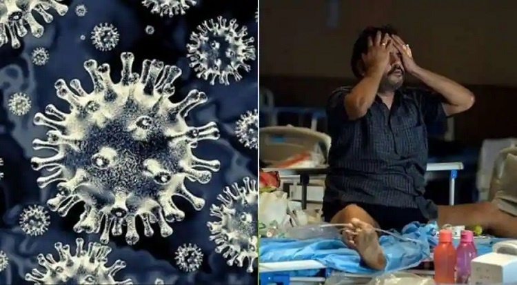 Mucormycosis