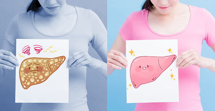 Fit to Fatty Liver